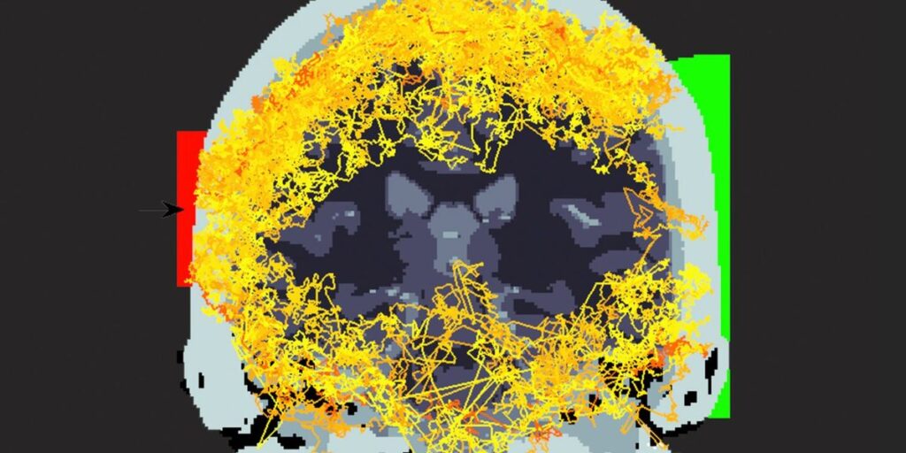 Affordable Optical Brain Imaging Advances