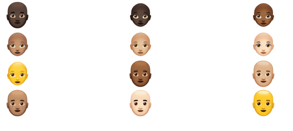 Are you balding? There’s an AI for that Are you balding? There’s an AI for that